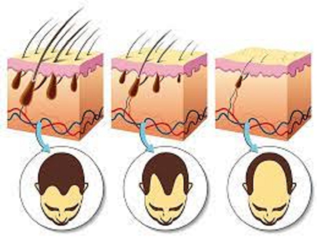 3 Easy Ways to Clean Hair Follicles!