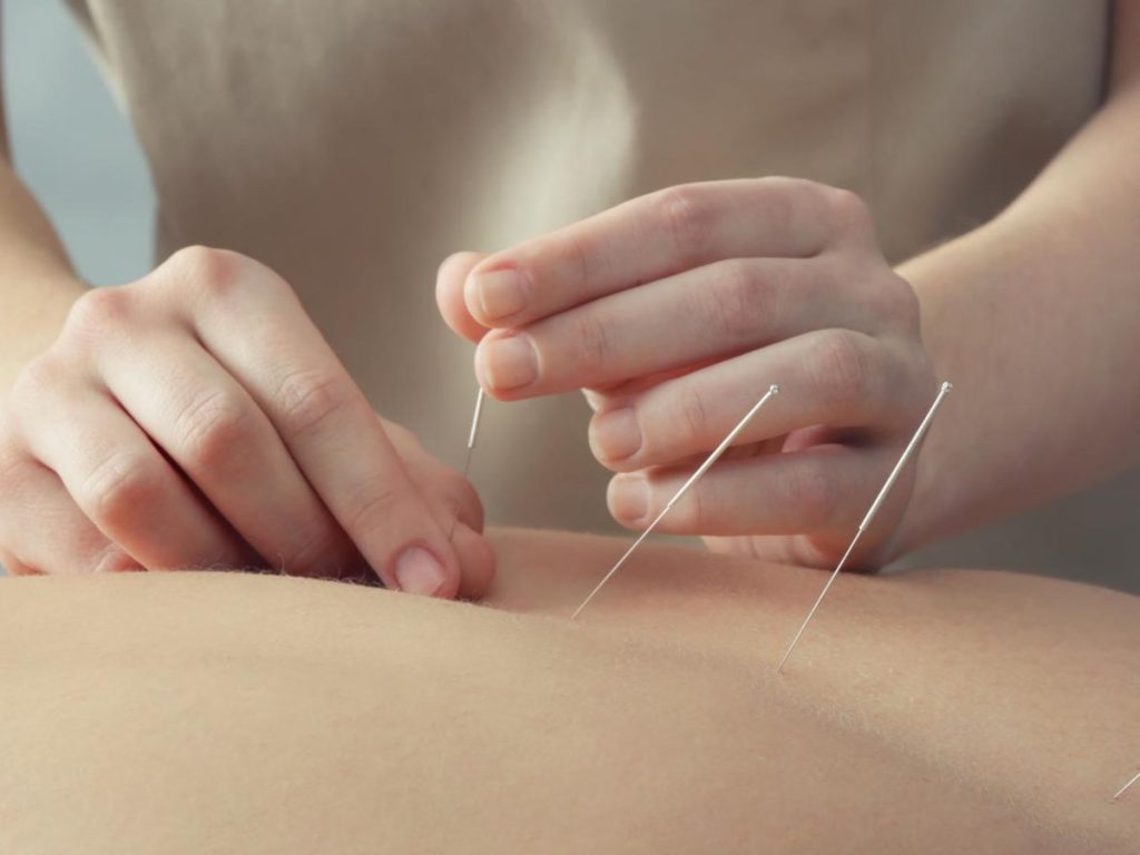 Discovering the Path to Wellness: Acupuncture & Homeopathy Medicine Centers